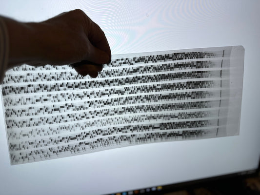 Human Genome Project: Gel Electrophoresis